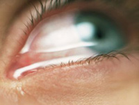 Болят веки глаз — почему болят веки? Что делать если болят веки глаз?