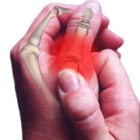 Заболевания, характеризующиеся болью в суставах пальцев рук