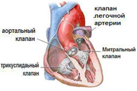 Митральный клапан сердца лечение