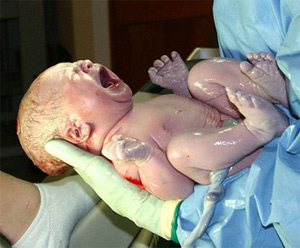 Это состояние называется катарсис новорожденного. Некоторые