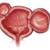 Дивертикулярная болезнь полых органов (желчный пузырь, мочеточник, уретра, мочевой пузырь, сердце)