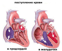 Болит ли сердце при пролапсе митрального клапана