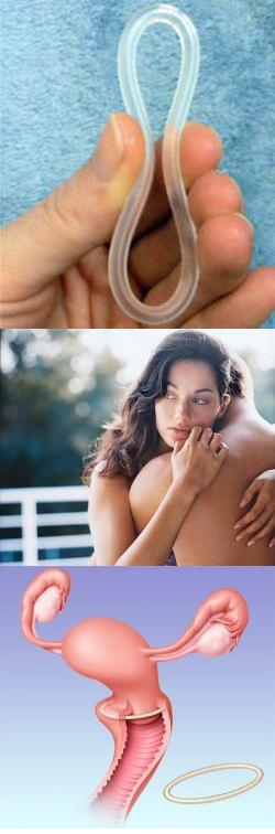 Вагинальное кольцо фото