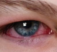 Капли для глаз офтальмоферон курс лечения