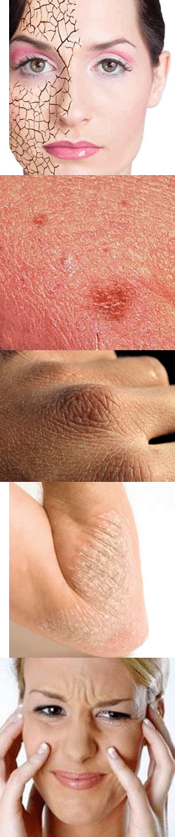 Грубая кожа на руках – как смягчить