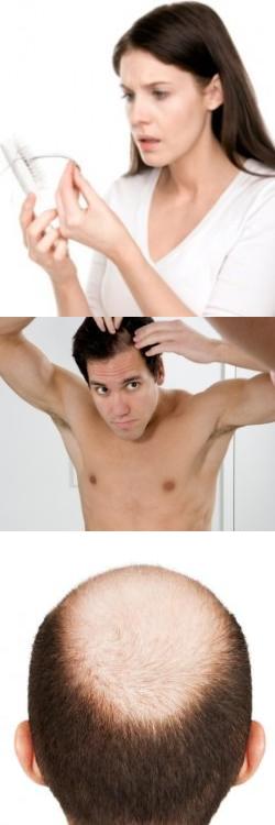 Очень сильно выпадают волосы что делать: отзывы врачей и как остановить и восстановиться