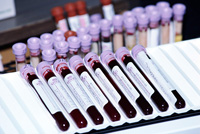 Сулемовая проба в анализе крови