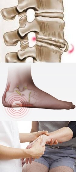 Остеофиты коленного сустава причины симптомы методы диагностики и лечения