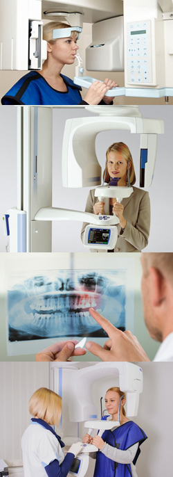 Панорамный снимок зубов, ортопантомограмма (ОПТГ): что такое в стоматологии, что показывает, расшифровка