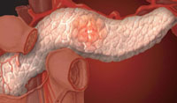 Болит желудок - карта болей внизу живота и всей брюшной полости