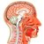 Саркома мозга, костей и мягких тканей головы и шеи