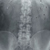 Рентген брюшной полости. Рентгенологическая картина здоровых органов брюшной полости. Рентгеновские методы в диагностике заболеваний органов брюшной полости
