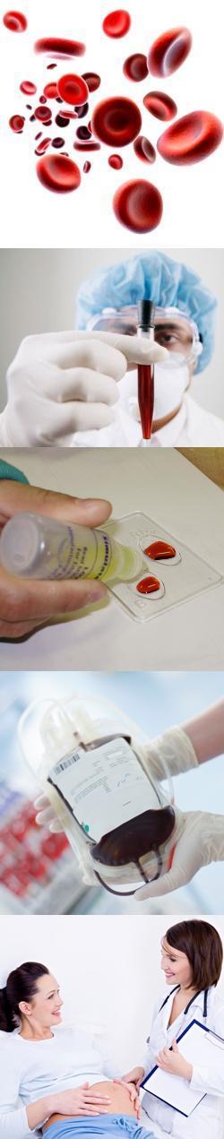 Группы крови и резус-фактор - анализы на определение, таблицы совместимости при переливании крови, какая группа крови и резус-фактор может быть у ребёнка
