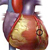 Атеросклероз венечных артерий сердца