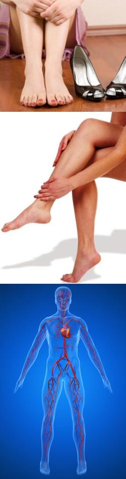 Почему возникает тяжесть в ногах ниже колена и ее лечение