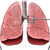 Симптомы и признаки астмы