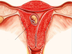 Можно Ли Заниматься Сексом После Имплантации Эмбриона