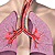 Классификация и диагностика бронхиальной астмы
