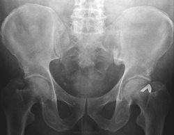Рентген почек: как делают обзорную рентгенографию, показания, подготовка