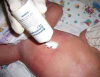 Банеоцин инструкция по применению порошка-присыпки и мази для новорожденных и детей до года