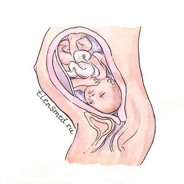 40 недель шевеление. Беременность 34 недели расположение. Расположение плода на 34 неделе беременности. Расположение ребенка на 34 неделе беременности. Расположение малыша в животе.