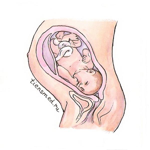 Плод 41 неделя. Расположение малыша в животе. Расположение ребенка в утробе. Расположение ребенка в матке. Расположение плода по неделям.