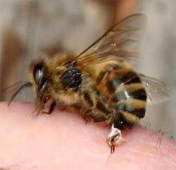 Пчелиный яд- новое слово в лечении витилиго