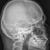 Рентген костей: виды рентгеновского исследования, методики исследования. Показания и противопоказания