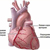 Классификация ишемической болезни сердца