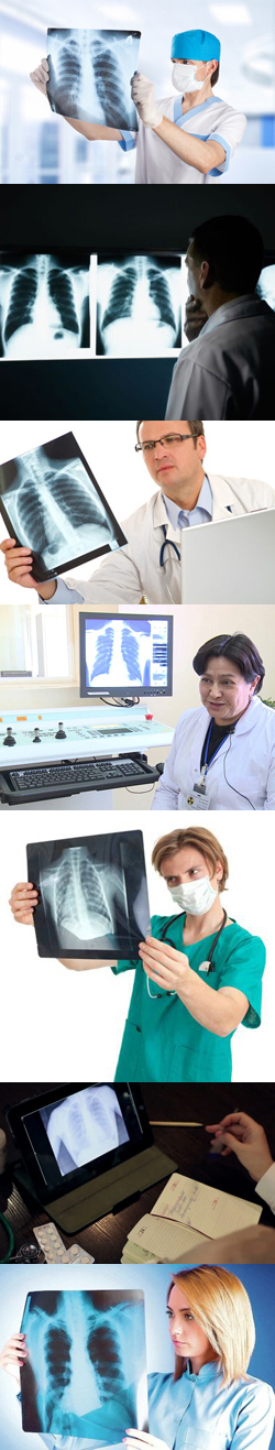 Покажет ли флюорография пневмонию: показания к проведению исследования, особенности подготовки, когда назначается, какие существуют методы диагностики легочных заболеваний