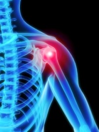 Три правила лечения вывиха плеча