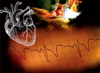 Что такое кардиограмма?