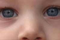 Акупунктура в борьбе с синдромом ленивого глаза у детей
