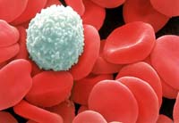 Как понизить уровень тромбоцитов в крови?