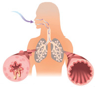 Ароматерапия при астме