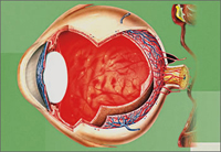 Причины развития ретинопатии