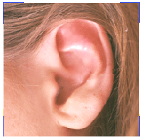 Фурункулы в ушах
