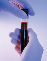 Для чего нужно сдавать анализ крови на гонадотропин?