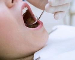 Кариес - самое распространенное заболевание зубов