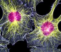 Стволовые клетки – вот что поможет победить энцефалопатию