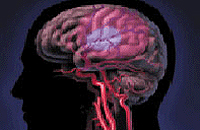 Хроническая ишемия головного мозга