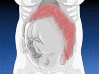 Кишечник во время беременности