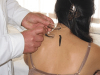 Использование гирудотерапии в косметологии