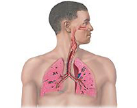 Инфекционная гранулема верхних дыхательных путей