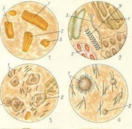 Растительная клетчатка в копрограмме. Микроскопия кала копрограмма. Копрологическое исследование микроскопия препаратов кала. Соединительная ткань кал копрограмма. Микроскопия кала мышечные волокна.