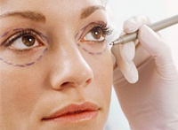 Синдром сухого глаза – осложнение косметических операций на веках