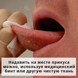 Прикусила язык болят уши