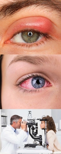 Воспаление глаз лечение врачи